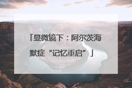显微镜下：阿尔茨海默症“记忆重启”